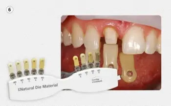 1 kpl. dental IPS Natural Die Material Shade Guide Ivoclar Vivadent ND1-9 występów fornir Teerth wybielanie