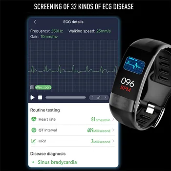 EKG PPG HR/BP Smart Band Watch HRV Form 24 H fitness-tracker opaskę Smartband dla IOS/Xiaomi/Honor PK Mi Band 4/Verga 5 Not