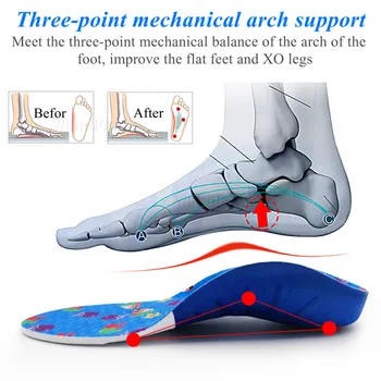 EVA Plac ortopedyczna wkładka dla płaskostopia Arch Support Kids foot flat foot inserts OX Leg ortopedyczna wkładka opieki wstaw Pad