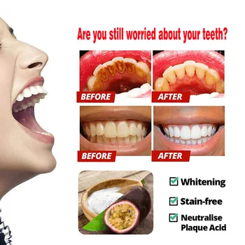 Intensywny odplamiacz, wybielająca pasta do zębów anti krwawiące dziąsła szczoteczką do zębów do czyszczenia zębów Le dentifrice Dentifricio RT9