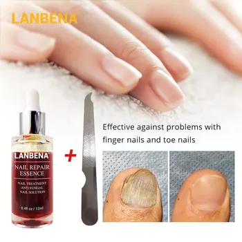 LANBENA fungal naprawa paznokci serum serum opieki leczenie stóp usuwanie grzyba paznokci żel anty infekcja grzybica paznokci zanokcica (choroba)